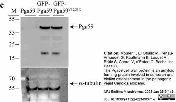 Anti Tubulin Alpha Antibody, clone YL1/2 gallery image 27