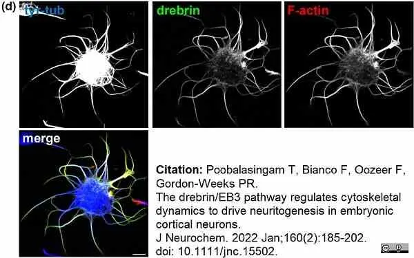 Anti Tubulin Alpha Antibody, clone YL1/2 gallery image 31