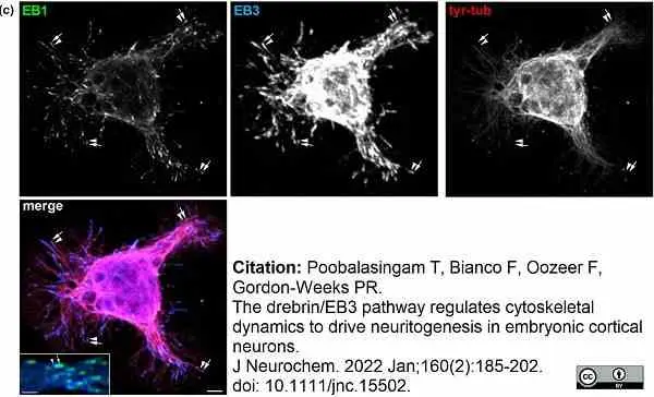Anti Tubulin Alpha Antibody, clone YL1/2 gallery image 32