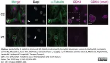 Anti Tubulin Alpha Antibody, clone YL1/2 gallery image 38