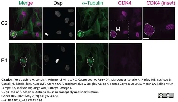 Anti Tubulin Alpha Antibody, clone YL1/2 gallery image 38