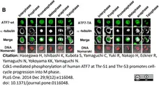 Anti Tubulin Alpha Antibody, clone YOL1/34 gallery image 12