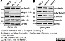 Anti Tubulin Alpha Antibody, clone YOL1/34 gallery image 13