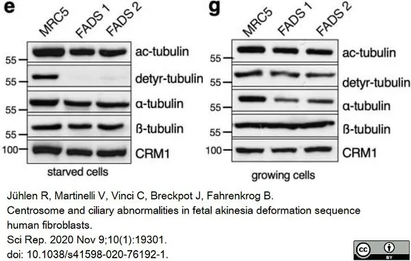 Anti Tubulin Alpha Antibody, clone YOL1/34 gallery image 13