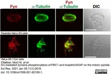 Anti Tubulin Alpha Antibody, clone YOL1/34 gallery image 16