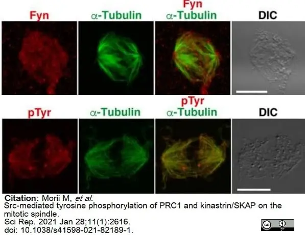 Anti Tubulin Alpha Antibody, clone YOL1/34 gallery image 17