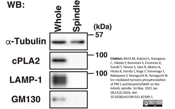 Anti Tubulin Alpha Antibody, clone YOL1/34 gallery image 18