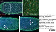 Anti Tubulin Alpha Antibody, clone YOL1/34 gallery image 2