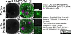 Anti Tubulin Alpha Antibody, clone YOL1/34 gallery image 21