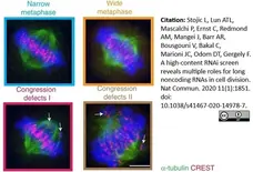 Anti Tubulin Alpha Antibody, clone YOL1/34 gallery image 27