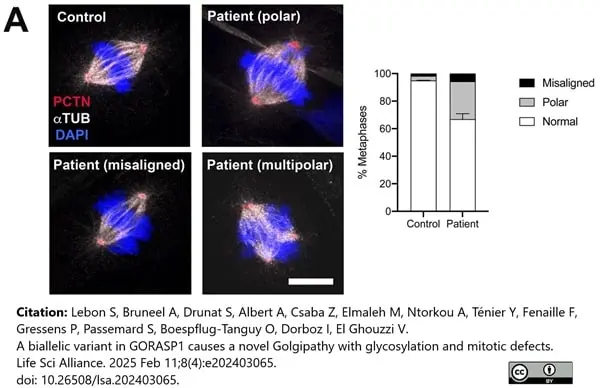 Anti Tubulin Alpha Antibody, clone YOL1/34 gallery image 31