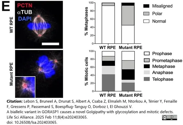 Anti Tubulin Alpha Antibody, clone YOL1/34 gallery image 32