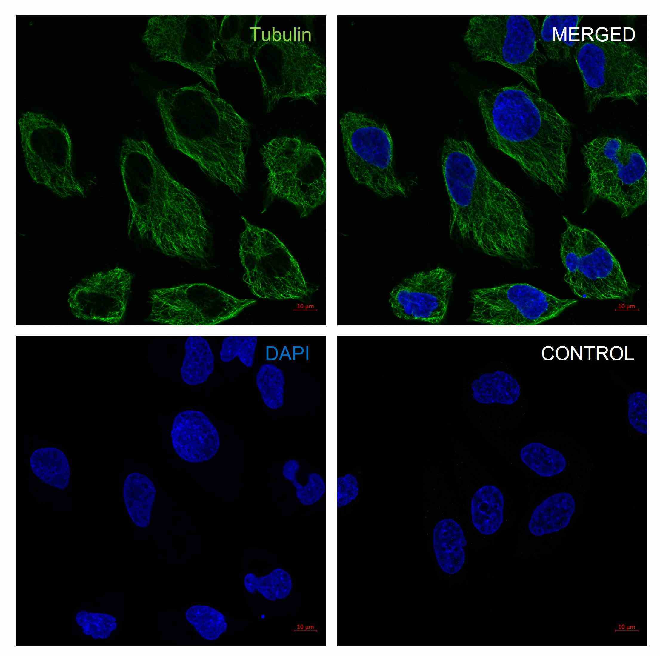 Anti Tubulin Alpha Antibody, clone YOL1/34 (PrecisionAb Monoclonal Antibody) gallery image 2