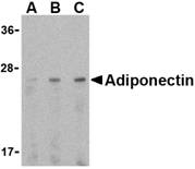Anti Adiponectin (C-Terminal) Antibody gallery image 1