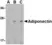 Anti Adiponectin (C-Terminal) Antibody thumbnail image 1