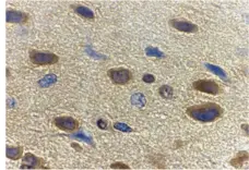 Anti Adiponectin (C-Terminal) Antibody gallery image 2