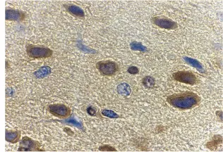 Anti Adiponectin (C-Terminal) Antibody gallery image 2