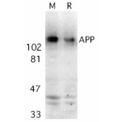 Anti Amyloid Precursor Protein (C-Terminal) Antibody gallery image 1