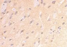 Anti Amyloid Precursor Protein (C-Terminal) Antibody gallery image 2
