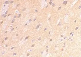 Anti Amyloid Precursor Protein (C-Terminal) Antibody gallery image 2