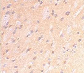Anti Amyloid Precursor Protein (C-Terminal) Antibody gallery image 2