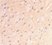 Anti Amyloid Precursor Protein (C-Terminal) Antibody thumbnail image 2