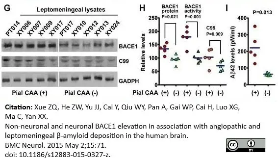 Anti Amyloid Precursor Protein (C-Terminal) Antibody gallery image 4