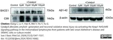 Anti Amyloid Precursor Protein (C-Terminal) Antibody gallery image 5
