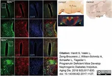 Anti Arginine Vasopressin Antibody gallery image 1