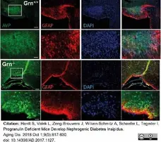 Anti Arginine Vasopressin Antibody gallery image 2