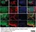 Anti Arginine Vasopressin Antibody thumbnail image 2