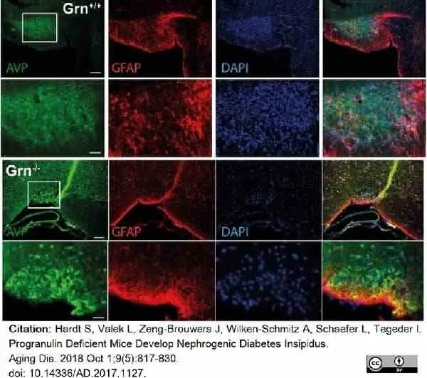 Anti Arginine Vasopressin Antibody gallery image 2