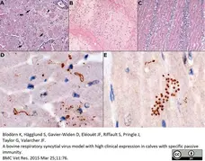 Anti Borrelia burgdorferi Antibody gallery image 1