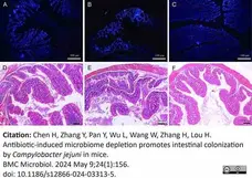 Anti Campylobacter jejuni Antibody gallery image 1