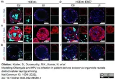 Anti Chlamydia trachomatis MOMP Antibody gallery image 1