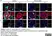 Anti Chlamydia trachomatis MOMP Antibody thumbnail image 1