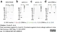 Anti Diphtheria Toxin Antibody gallery image 1
