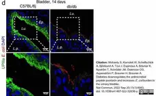Goat Anti Escherichia coli Antibody  gallery image 9