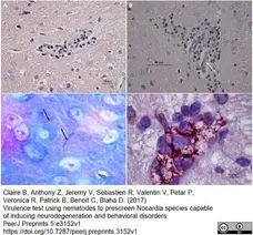Anti Mycobacterium tuberculosis Antibody gallery image 1