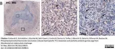 Anti Mycobacterium tuberculosis Antibody gallery image 3