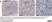 Anti Mycobacterium tuberculosis Antibody thumbnail image 3