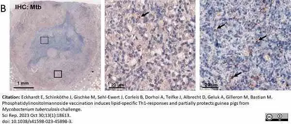 Anti Mycobacterium tuberculosis Antibody gallery image 3