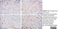 Anti GAP43 Antibody gallery image 1