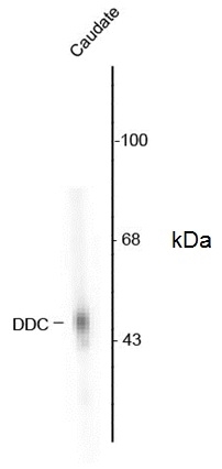 Anti Bovine DOPA Decarboxylase Antibody gallery image 1