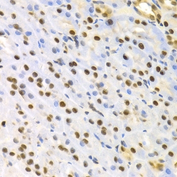 Anti 14-3-3 Sigma Antibody thumbnail image 5