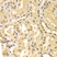 Anti 14-3-3 Sigma Antibody thumbnail image 7