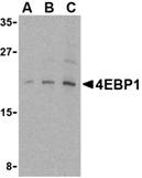 Anti 4EBP1 (C-Terminal) Antibody gallery image 1