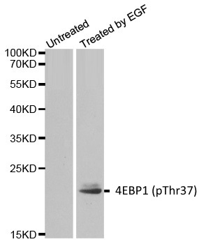 Anti 4EBP1 (pThr37) Antibody gallery image 1