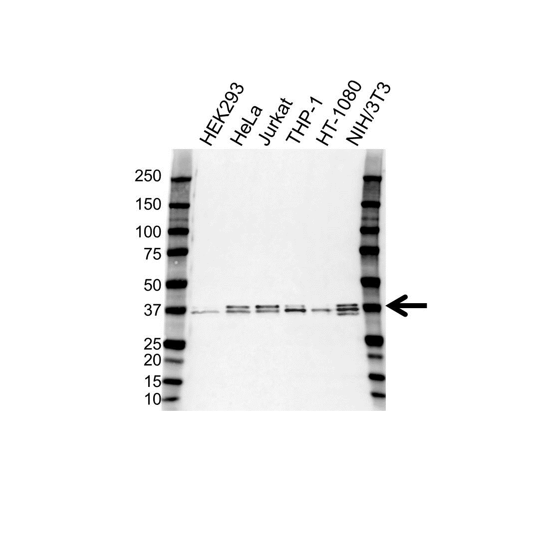 Anti A4GALT Antibody (PrecisionAb Polyclonal Antibody) gallery image 1