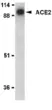 Anti Human ACE2 (N-Terminal) Antibody thumbnail image 1